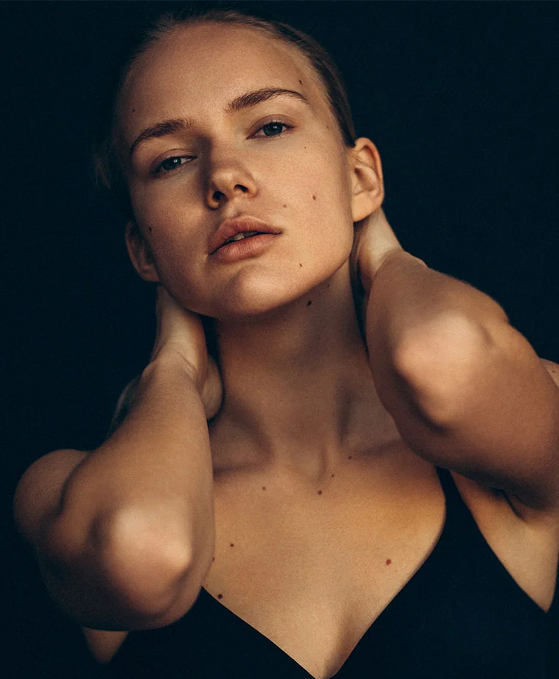 Close-up portrait of a young woman with light skin, freckles, and light brown hair pulled back. Her expression is pensive, and the dark background highlights her features, illuminated by soft, dramatic lighting. She wears a dark, sleeveless top. - Earlobe Reduction in Coral Gables, FL